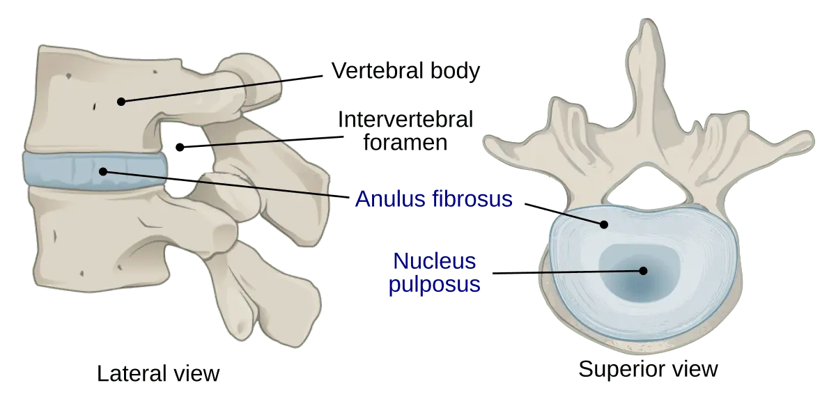 Intervertebral disc