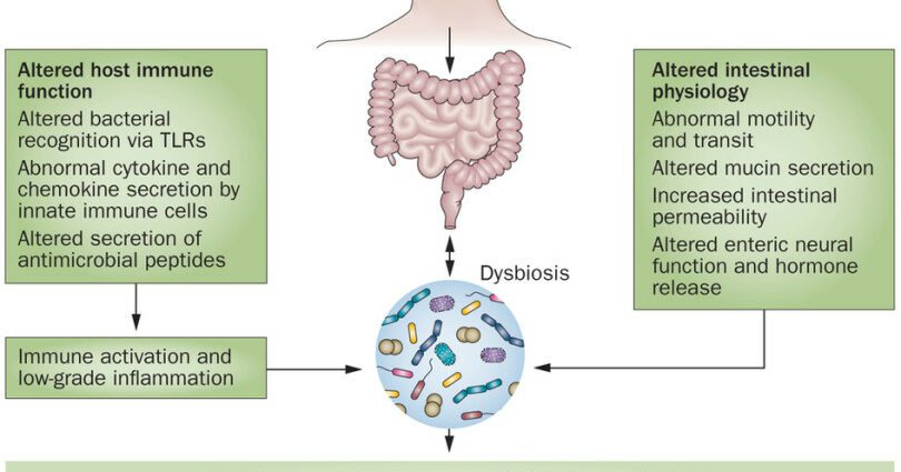 Intestinal dysbiosis: symptoms and treatment in adults