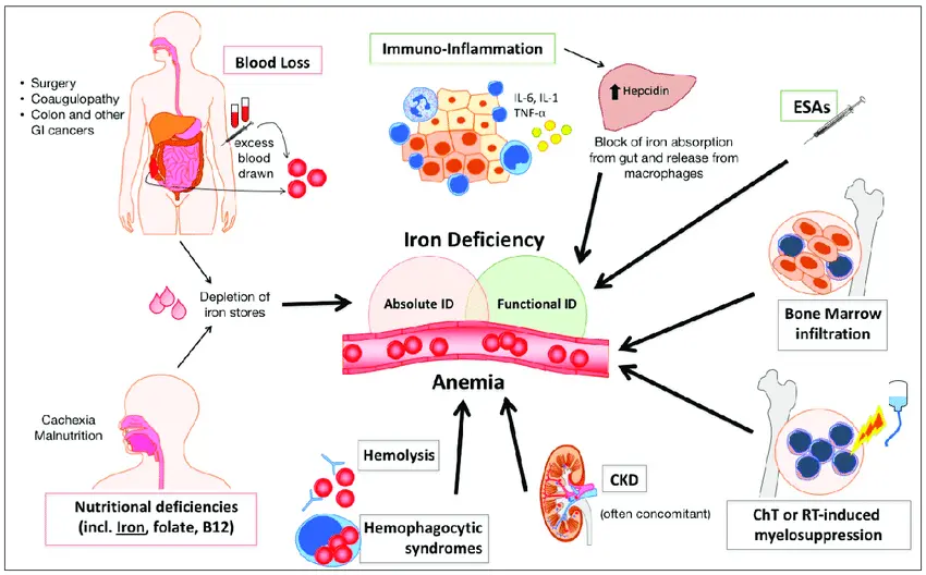 Anemia &#8211; Sites of interest