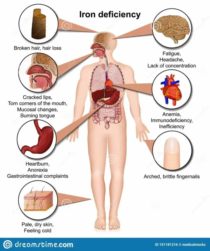 Iron deficiency in the body: how to replenish