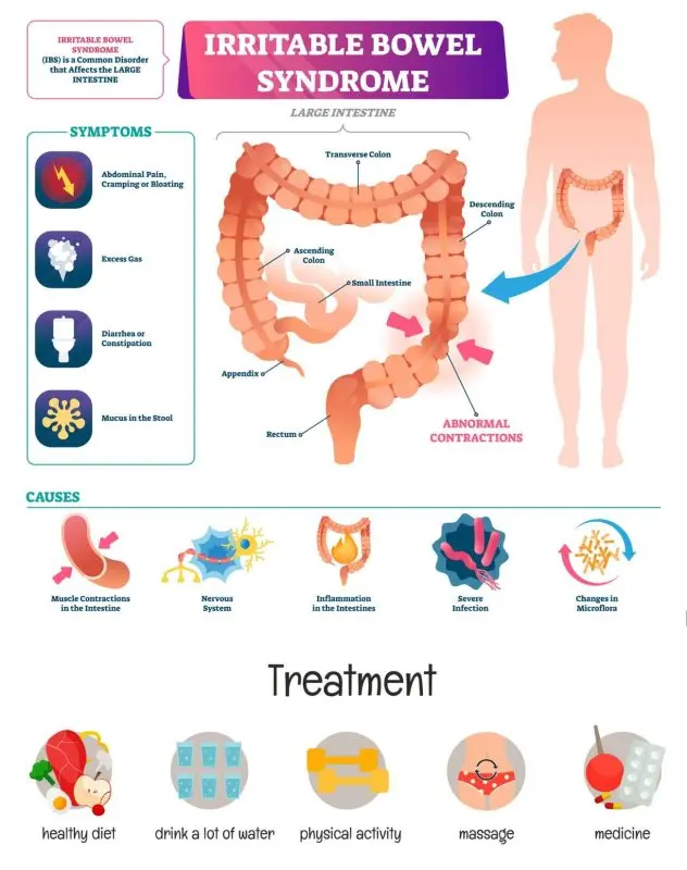 Irritable Bowel Syndrome &#8211; Symptoms of Irritable Bowel Syndrome