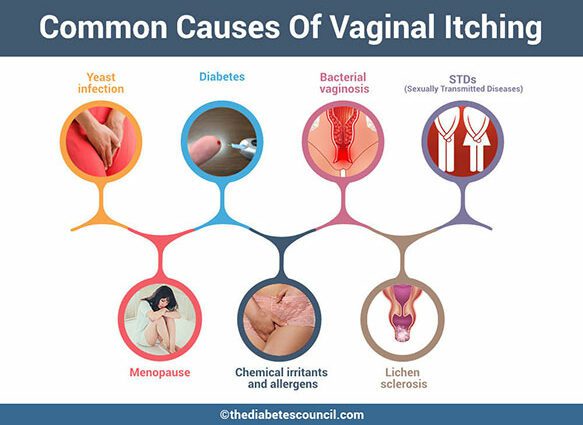 Itching of the vulva