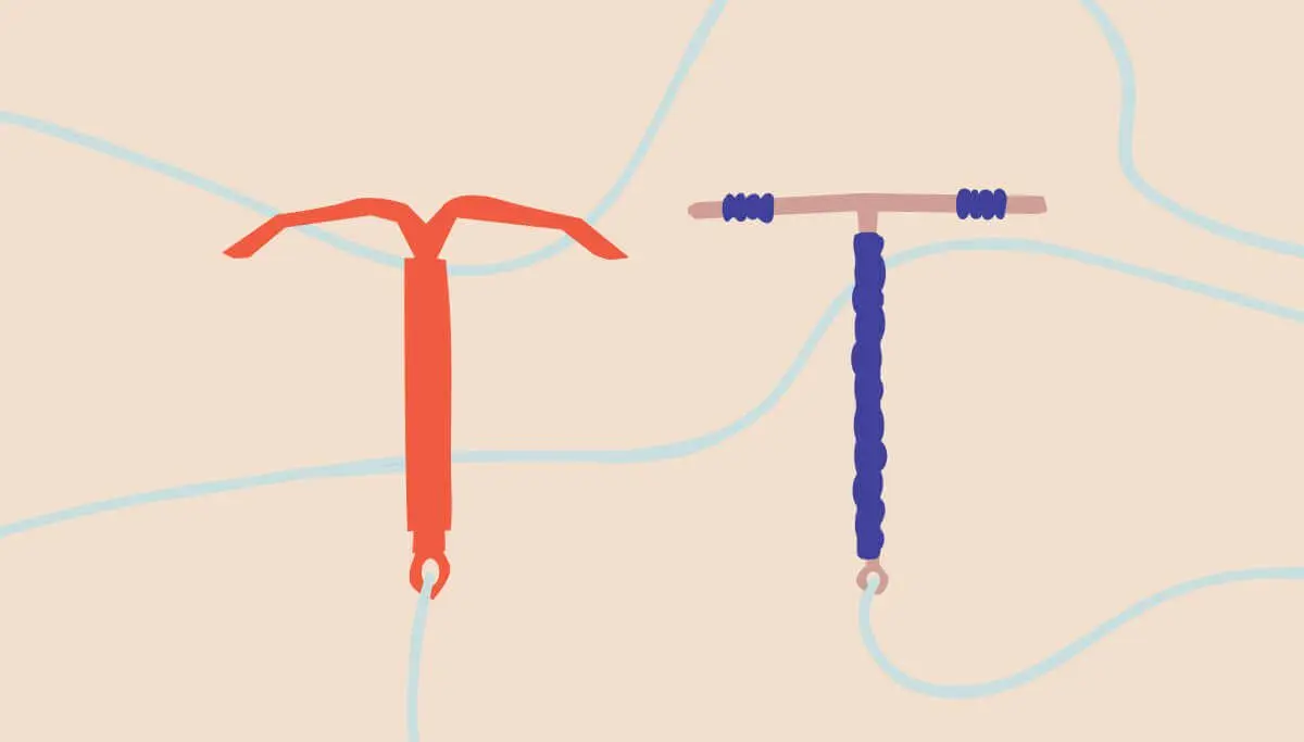 IUD: all about the IUD before pregnancy