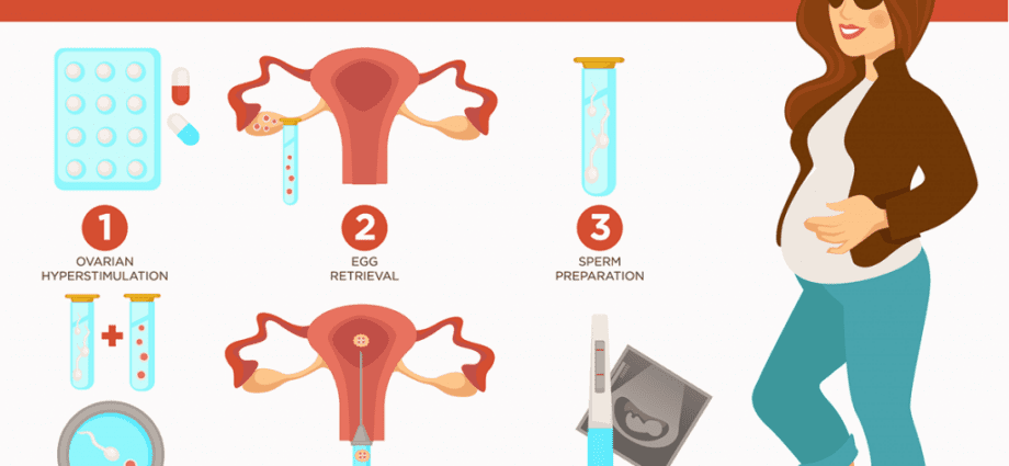 IVF side effects, consequences and risks of IVF