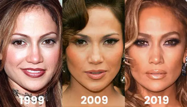 Jennifer Lopez plastic surgery