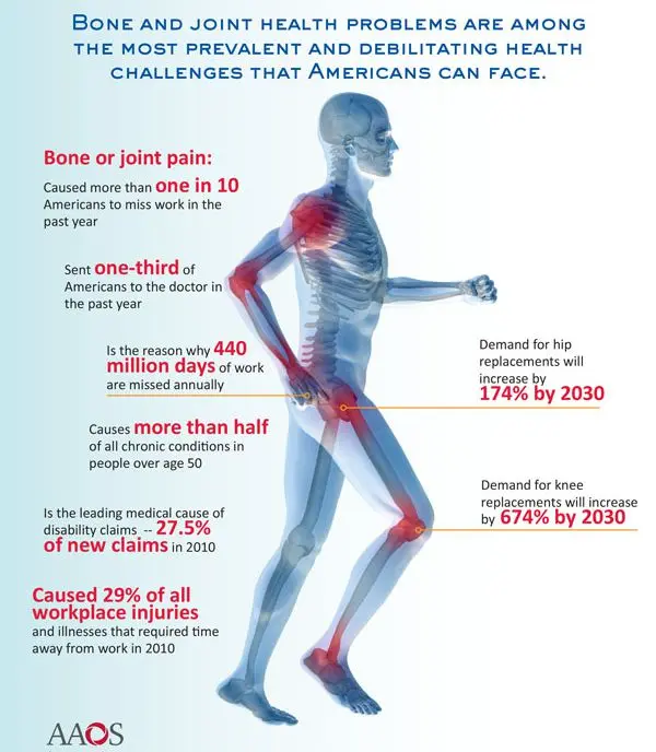 Joint pain: why joints hurt, what to do and how to get rid of