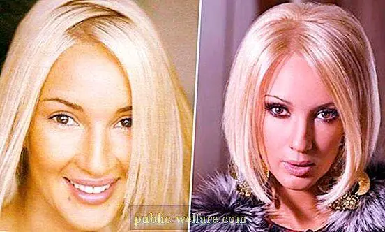 Kandelaki and Sedokova: Russian stars without makeup