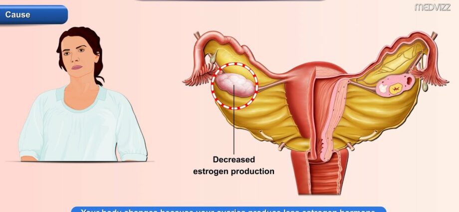 Menopawsa (menopawsa): sintomi u trattament. Vidjo