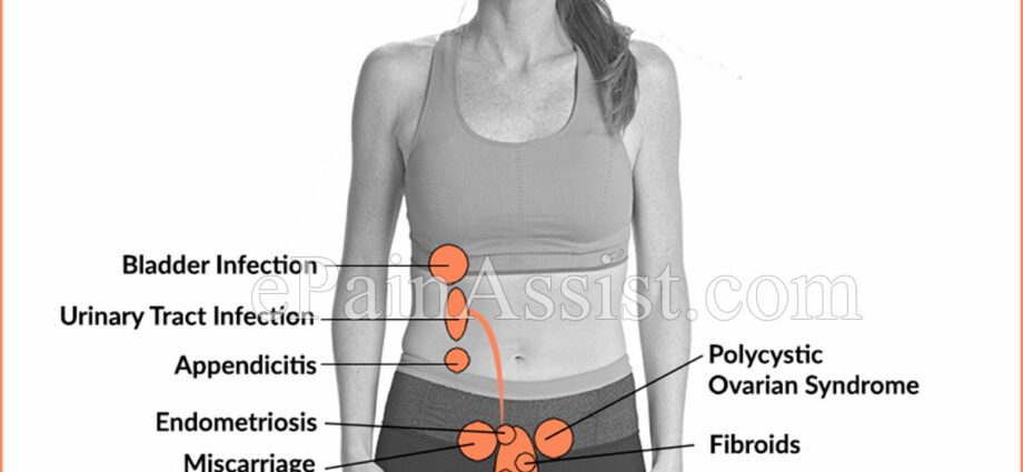 Lower abdomen pain