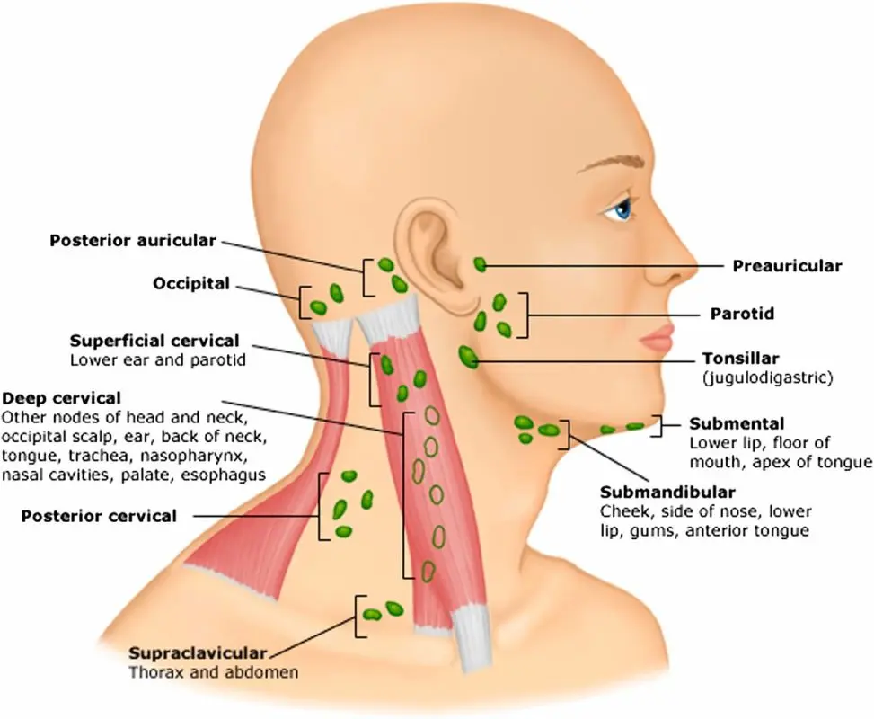 Lymphadenopathy