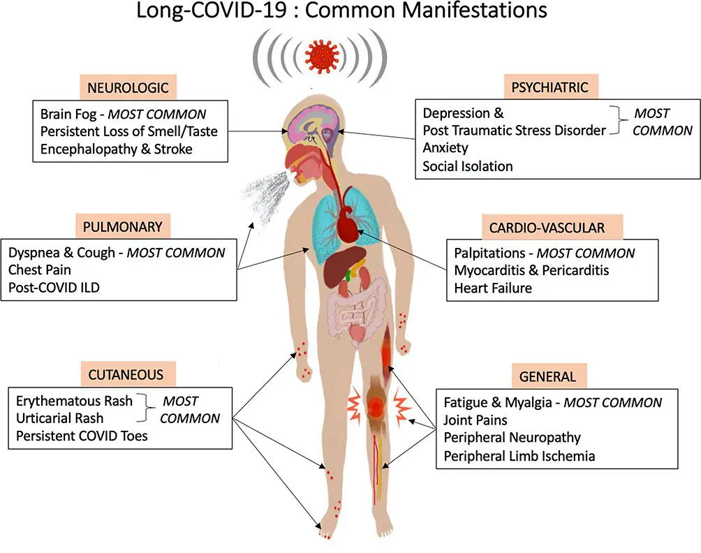 Malysheva voiced the main symptom for hospitalization with COVID-19