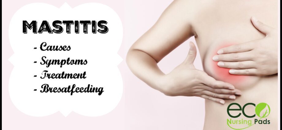 Mastitis: causes, symptoms and treatment