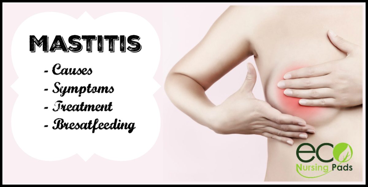 Mastitis መንስኤዎች ፣ ምልክቶች እና ህክምና በአቅራቢያዬ ጤናማ ምግብ