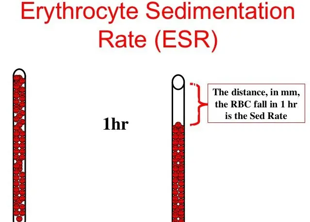 Measurement of the sedimentation rate in the blood