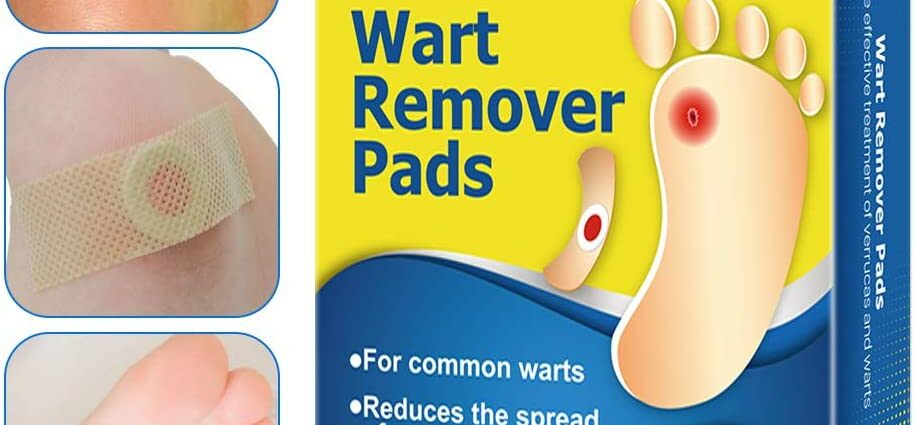 Medical treatments for common and plantar warts