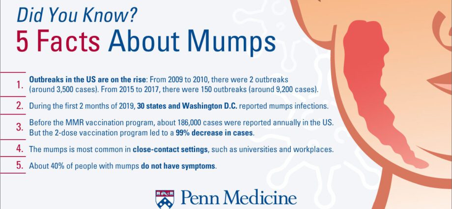 Mumps – Te whakaaro o ta matou takuta