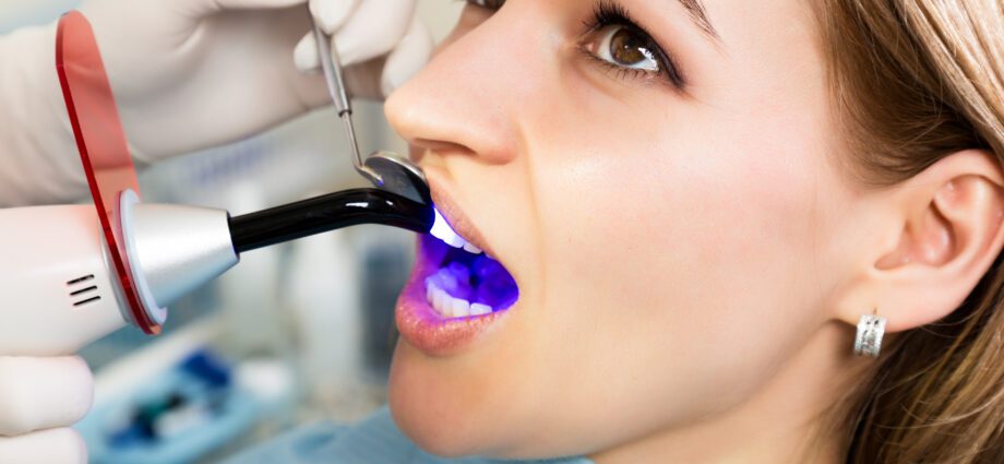 牙垢的藥物治療（洗牙和牙菌斑）