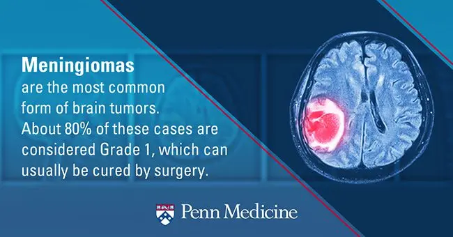 Meningioma: causes, symptoms and treatments