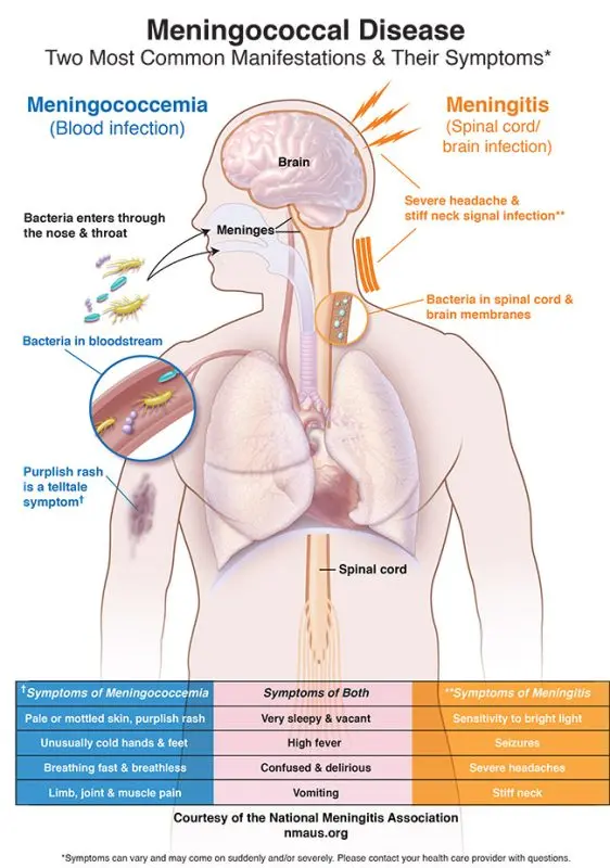 Meningococcal meningitis: causes, symptoms and treatment