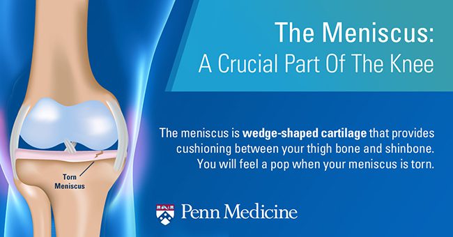 Менискус: менискус жарықшағын анықтау және емдеу