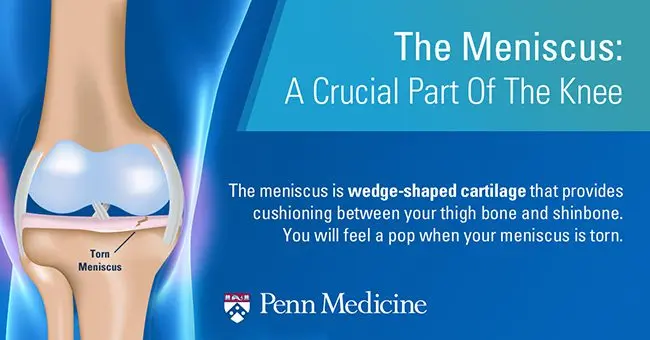 Meniscus: definition and treatment of meniscus fissure