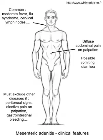 Mesenteric adenolymphitis