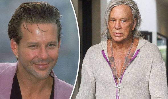 Mickey Rourke All Plastic Surgery 2017