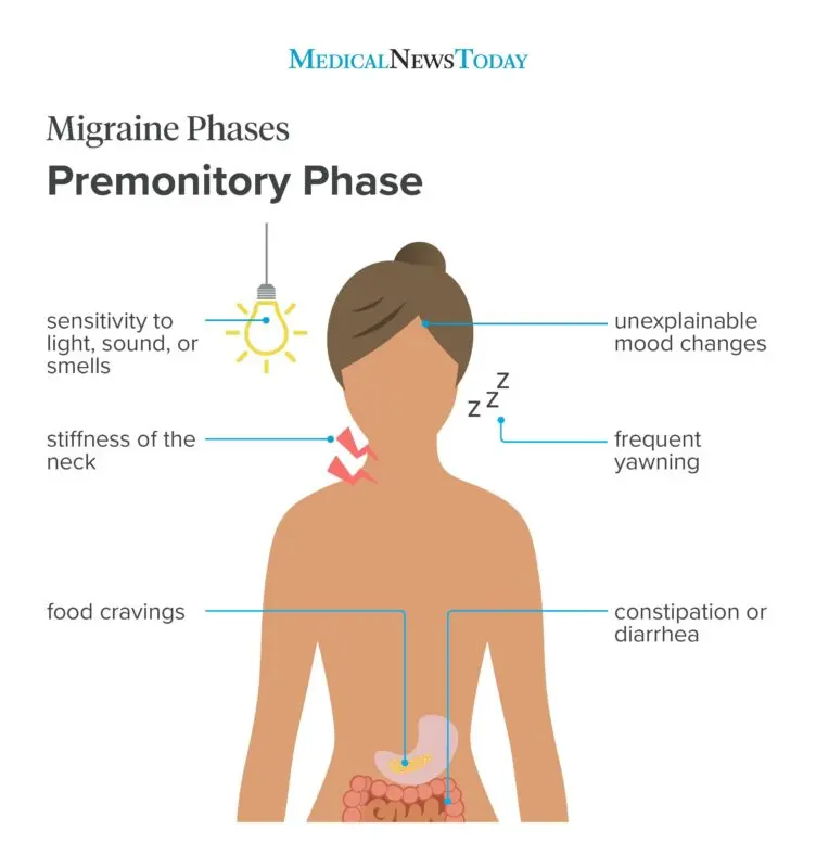 Migraine symptoms in women