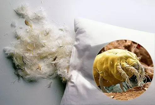 Mites in pillows, feathers, dust