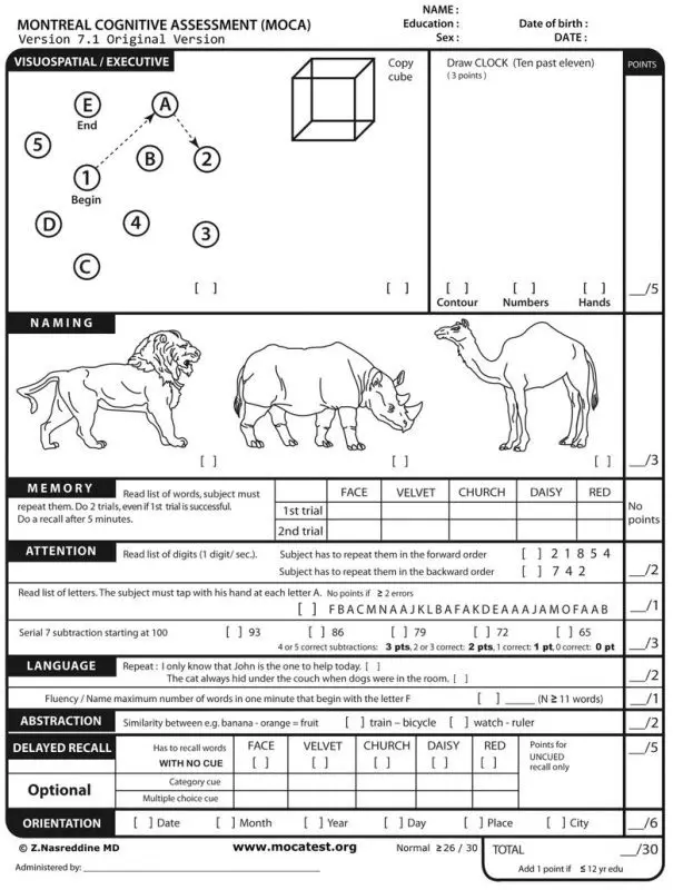 moca test and others for dementia