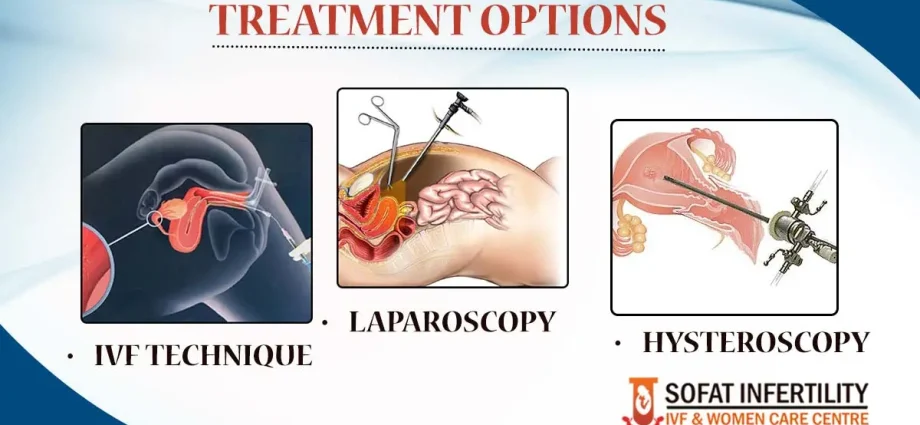 Modern methods of infertility treatment