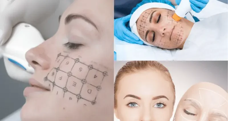 Modern methods of rejuvenation without surgery