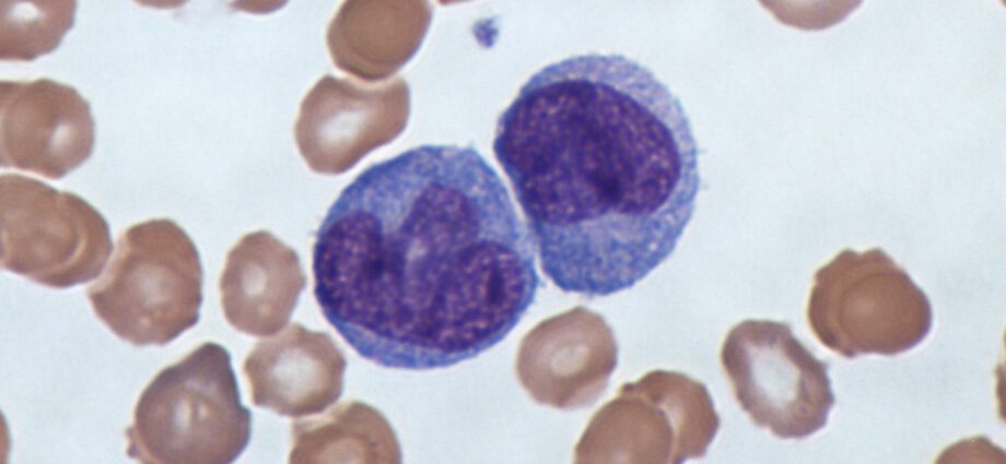 Monocytes