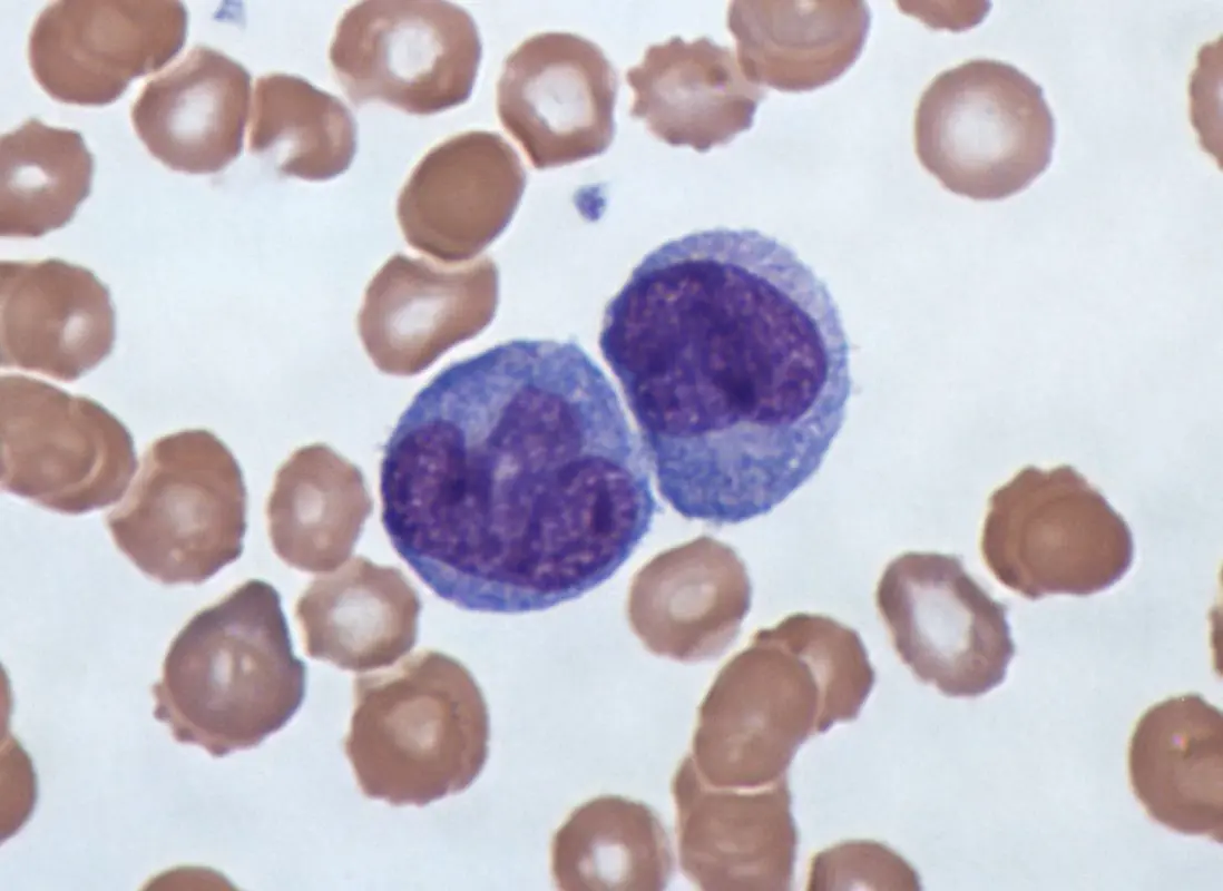 Monocytes