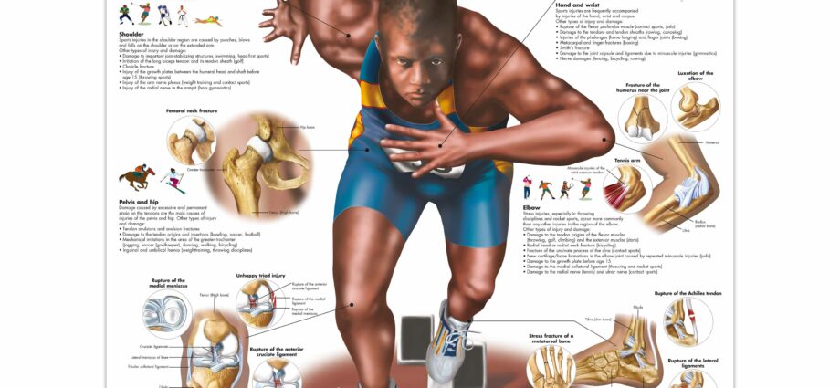 Ozljede mišića (sport)