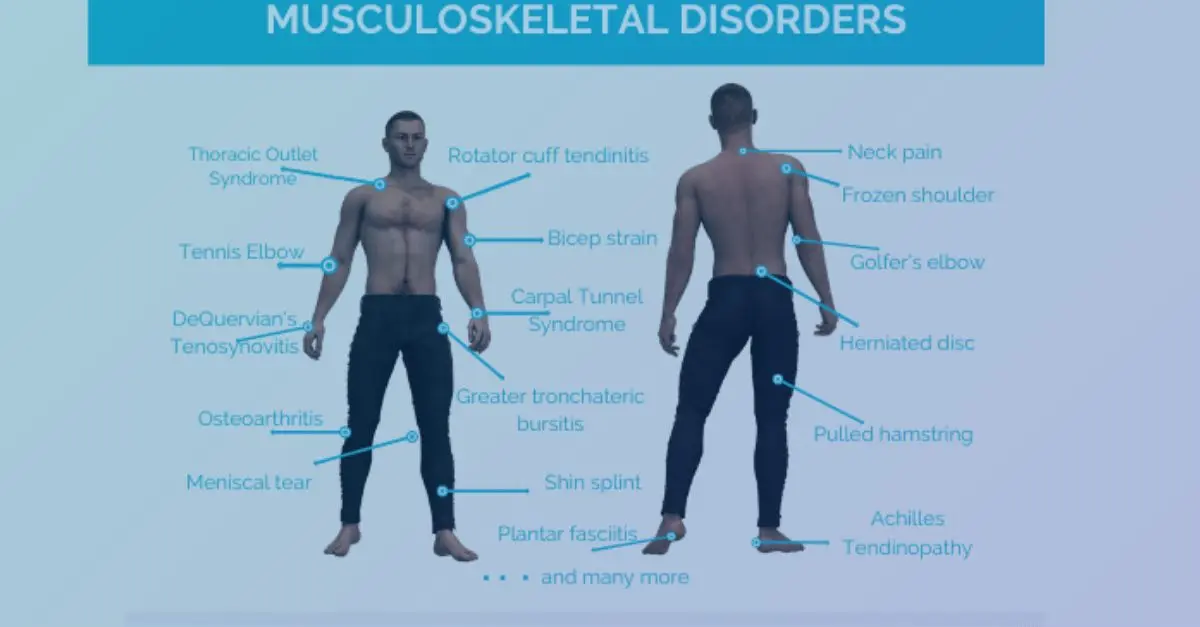 Musculoskeletal disorders of the elbow &#8211; Sites of interest