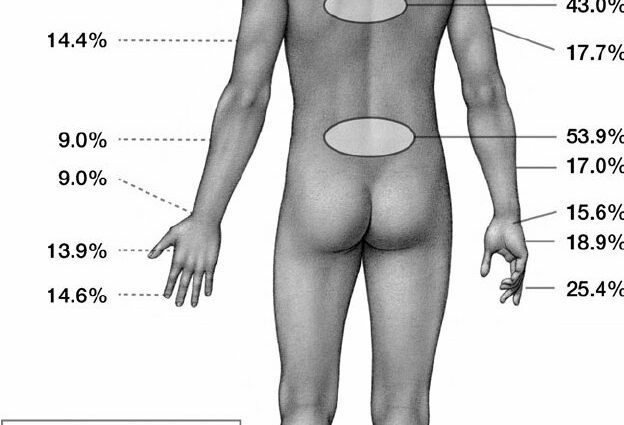 膝の筋骨格系障害–関心のある部位