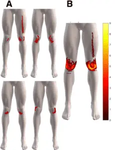 Musculoskeletal disorders of the knee