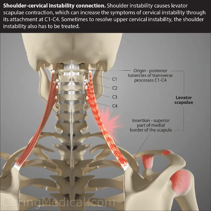 Musculoskeletal Neck Disorders &#8211; Our Doctor&#8217;s Opinion