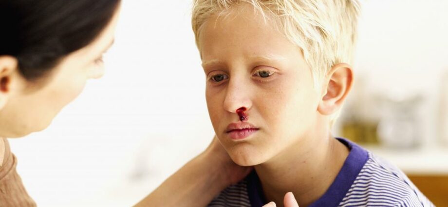Anak saya berdarah dari hidung: bagaimana bertindak balas?