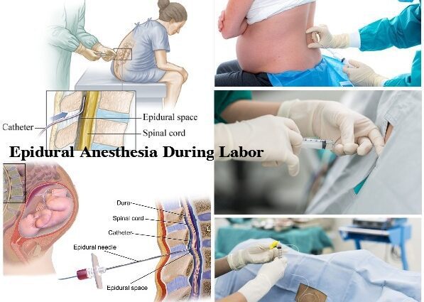 Anestesia durante o parto: por que se precisa?