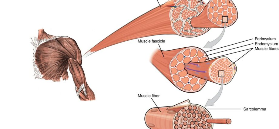 Myopathy