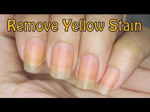 Nails turn yellow: what to do? Video – Healthy Food Near Me