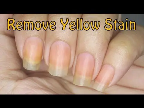 Nails turn yellow: what to do? Video
