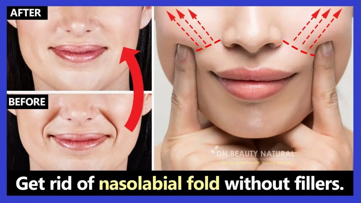 Nasolabial wrinkles: how to eliminate? Video