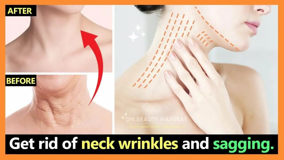 Neck folds: how to remove? Video