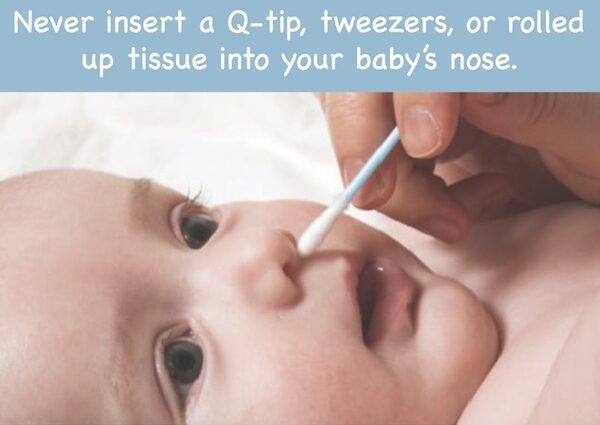 Newborn&#8217;s nose: how to clear a baby&#8217;s nose? Video