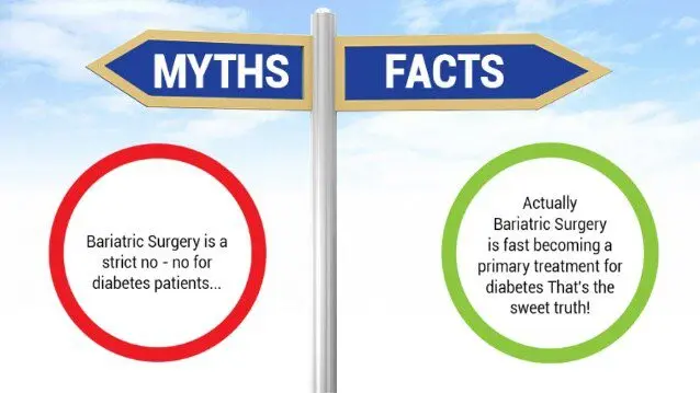 Obesity Surgery &#8211; Truth and Myths