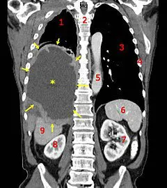 Oncology