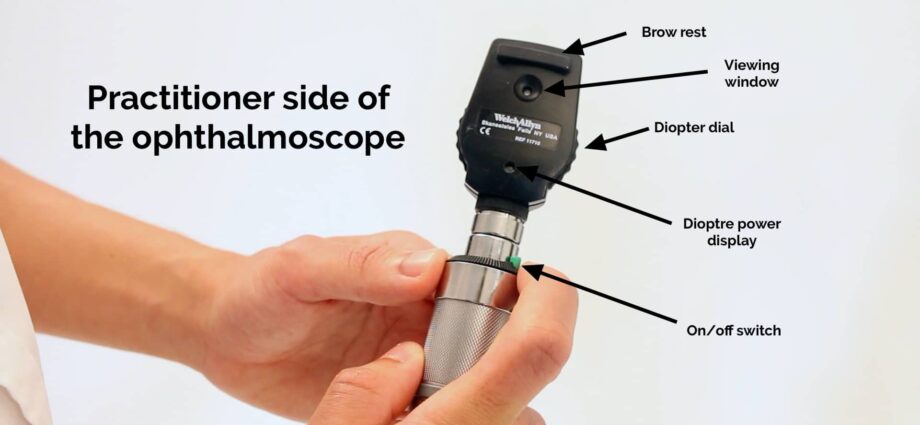 Ophthalmoscope: what is this tool for during an eye examination?